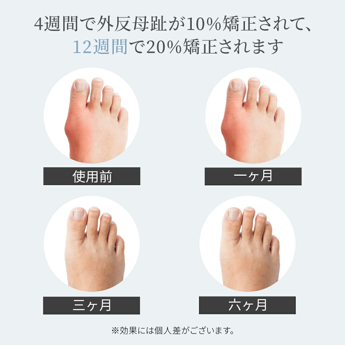 【2個セット】Tech Love　外反母趾サポーター 日本製 医療機器認証済