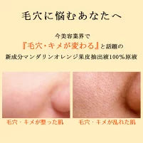 【3人シェア買いでお得】オラージュマンダリン10mL 毛穴 ケアに「マンダリンオレンジ果皮抽出液」100％原液美容液/毛穴 引き締めメB