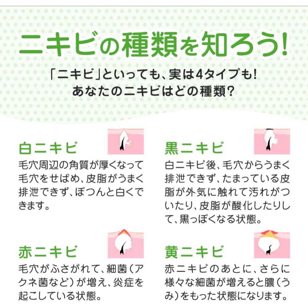 40mL×4袋 メンソレータム アクネス ニキビ予防薬用ふわふわ泡洗顔 詰替用