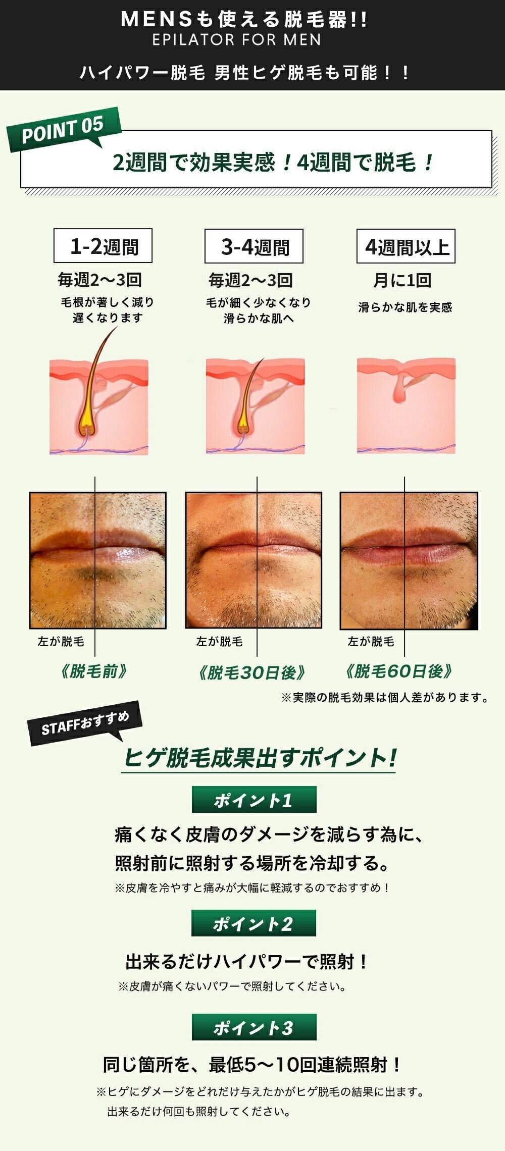 脱毛器 プロ仕様モデルＡＮＹＭＩProfessional（エニミープロフェッショナル）光フェイシャルランプ付き