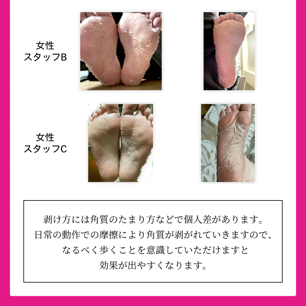 ましゅまろ素足 1回分 かかと 角質除去 足裏  両足×1回分 フットピーリング 時短 フットパック ペロリン 40分履くだけ 角質取り かかと ガサガサ ケア 足の臭い 角質 削る 足の裏 コスメ 化粧品 フットケア メール便 送料無料