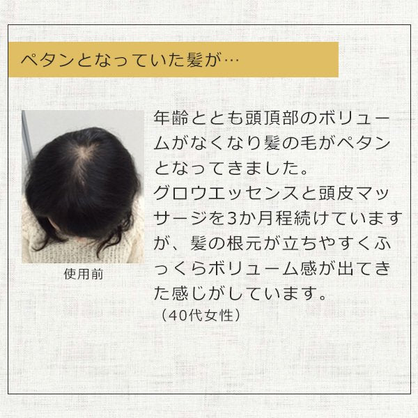 【3人シェア買いでお得】ヘアーモーメントＰ グロウエッセンス 155ml 育毛剤 女性用 養毛 育毛 薄毛対策 薄毛 抜け毛予防