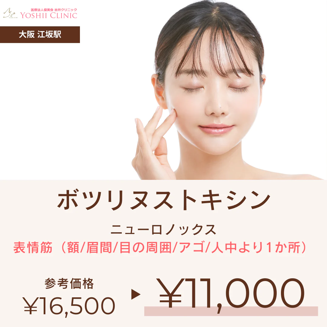 ボツリヌストキシン（ニューロノックス）表情筋（額、眉間、目の周囲、アゴ、人中より1か所）・吉井クリニック【美容クリニックチケット】