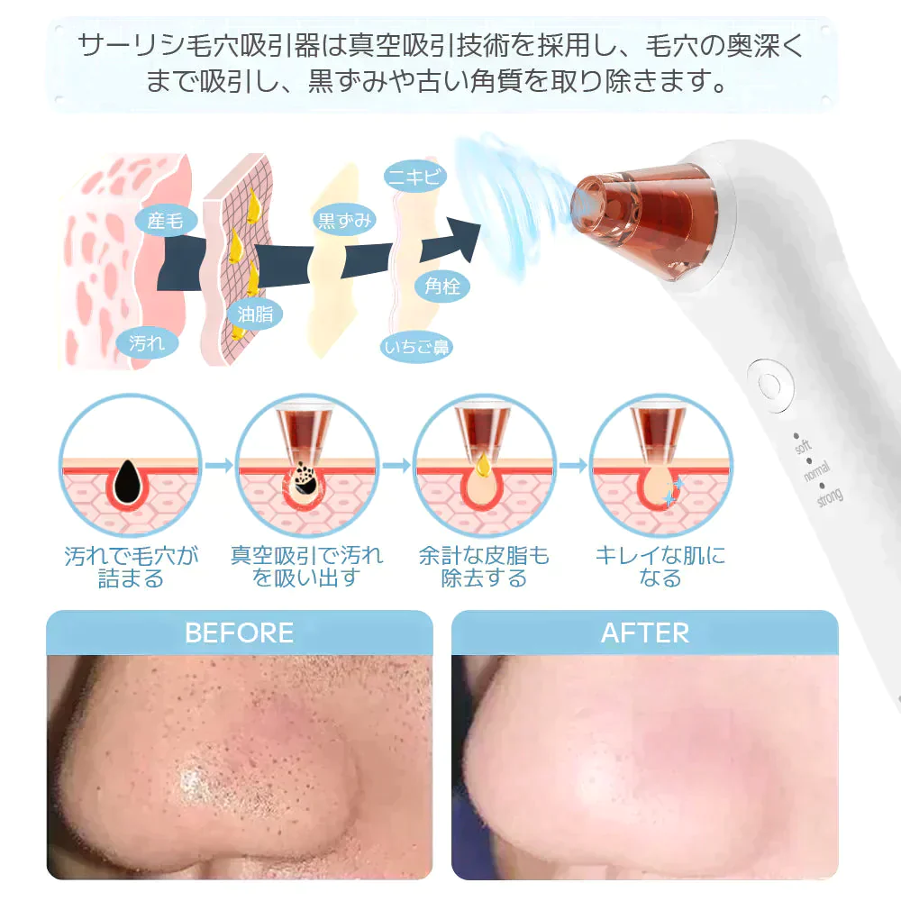 【超シェア買い祭】 Sarlisi毛穴吸引器 毛穴ケア 光エステ サーリシ 美顔器 ニキビ  イチゴ鼻対策 角栓取り 黒ずみ 毛穴クリーン 3段階吸引力調整 メンズ 角質ケア スキンケア ニキビ吸引 黒ずみ吸出し USB充電式 ４つの吸引ヘッド【エコ得】