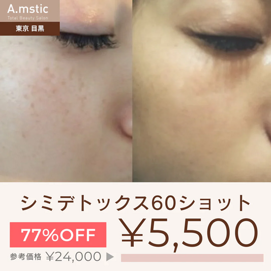 シミデトックス60ショット【美容サロンチケット】 エステ/美容/東京/目黒/A.mstic