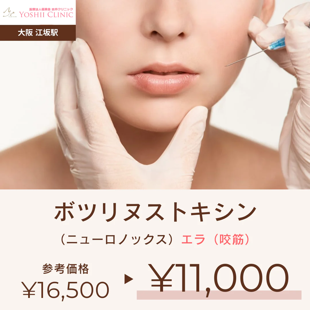 ボツリヌストキシン（ニューロノックス）エラ（咬筋）・吉井クリニック【美容クリニックチケット】