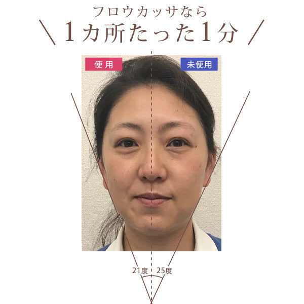 【3人シェア買いでお得】EMS 進化系かっさ 美顔器 フロウカッサ FLOW KASSA かっさ 美顔機 美顔 リフトアップ 顔 エビス化粧品