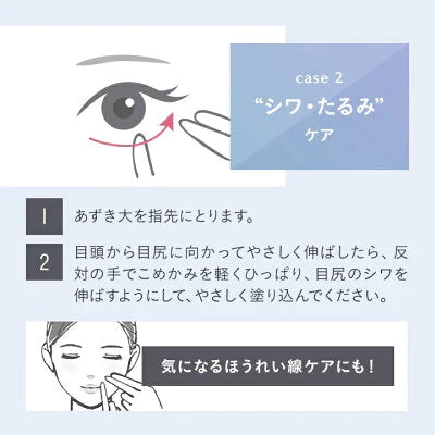 【5本セット】Le ment（ルメント）ホワイト ニング　アイセラム　目元美容液　アイクリーム　　美 白　クマ　くすみ　乾燥小ジワ　医薬部外品