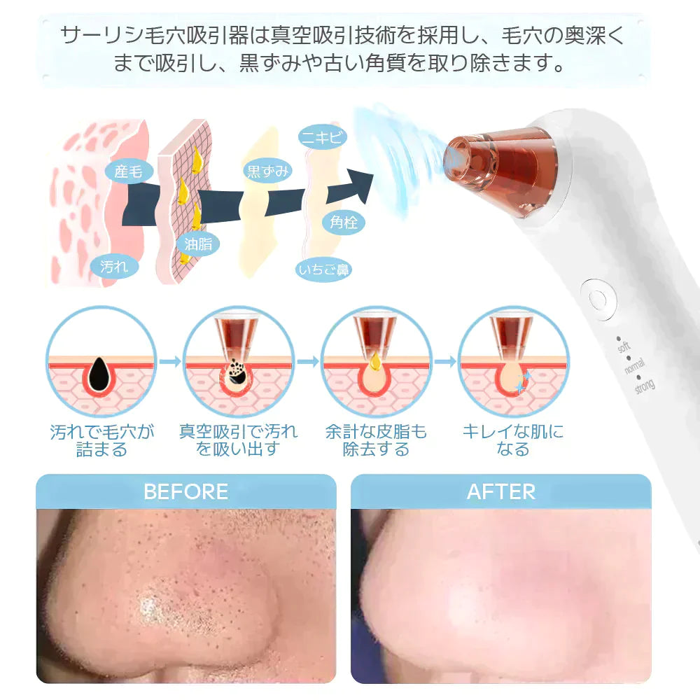 【超得ハイパーSALE】Sarlisi毛穴吸引器 毛穴ケア 光エステ サーリシ 美顔器 ニキビ  イチゴ鼻対策 角栓取り 黒ずみ 毛穴クリーン 3段階吸引力調整 メンズ 角質ケア スキンケア ニキビ吸引 黒ずみ吸出し USB充電式 ４つの吸引ヘッド
