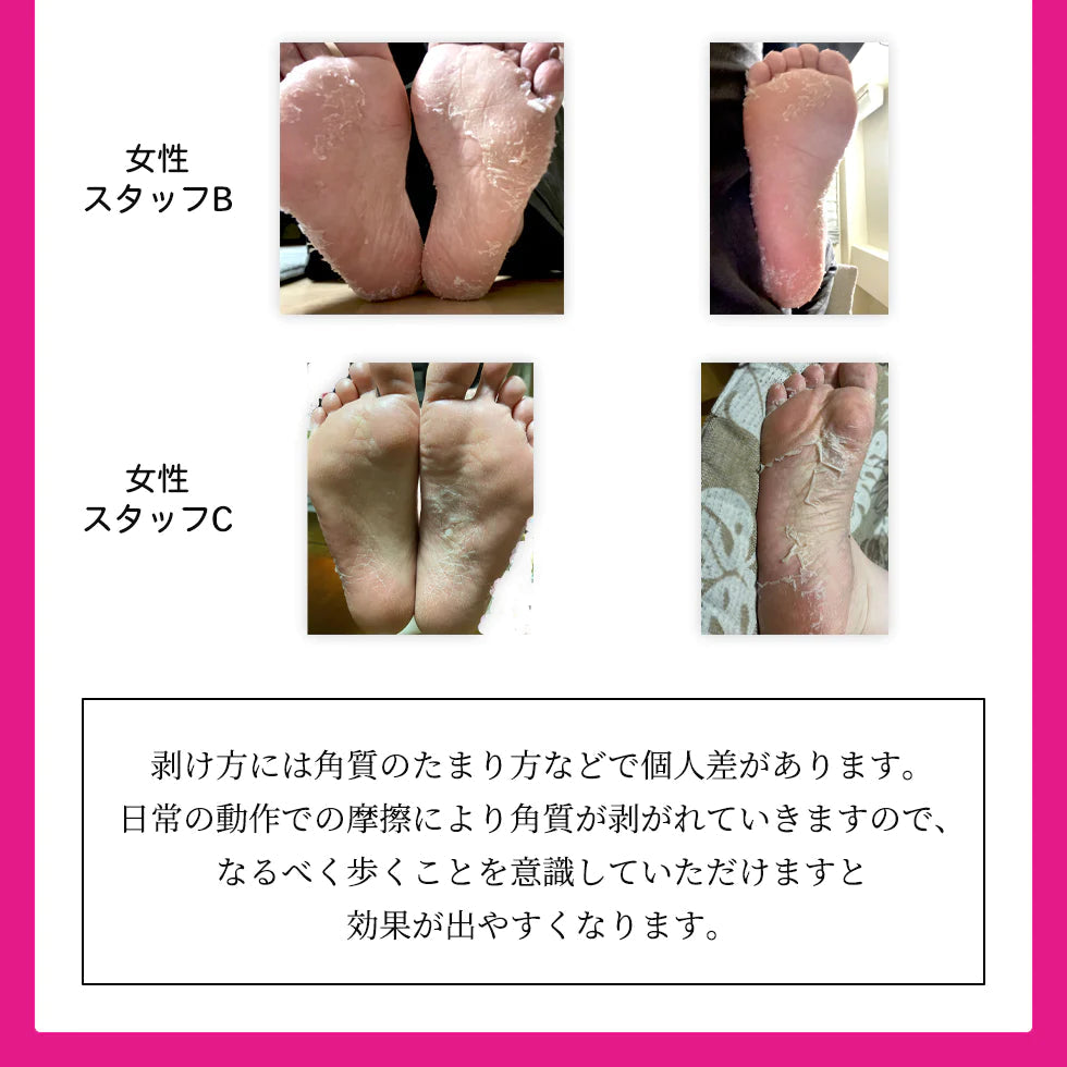 【100円シェア買い】ましゅまろ素足 1回分 かかと 角質除去 足裏  両足×1回分 フットピーリング 時短 フットパック ペロリン 40分履くだけ 角質取り かかと ガサガサ ケア 足の臭い 角質 削る 足の裏 コスメ 化粧品 フットケア メール便 送料無料