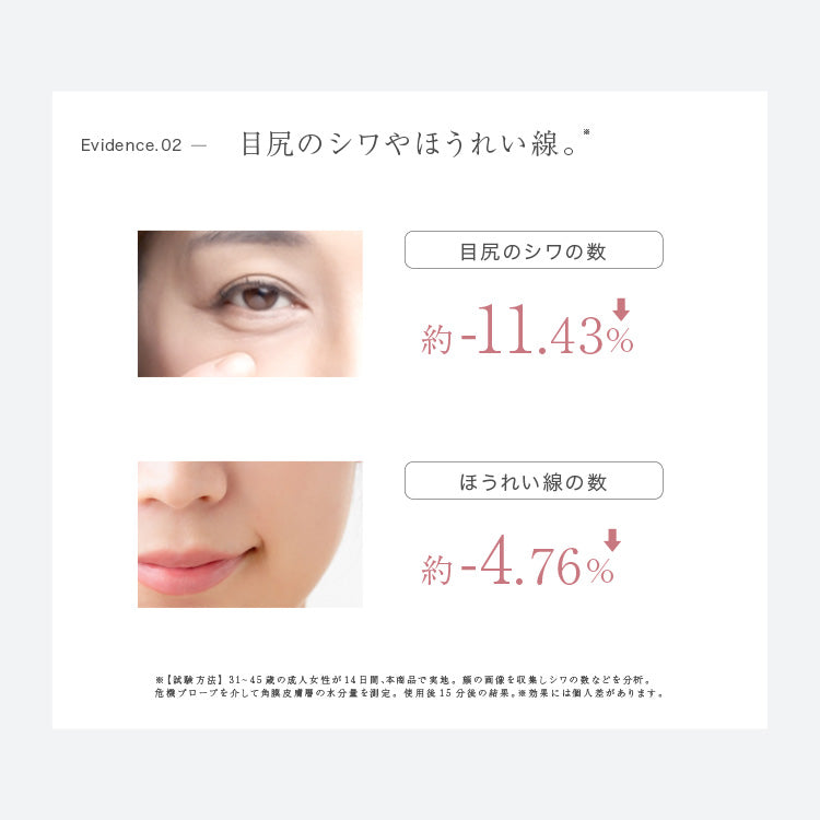 【LOABI公式】 Espelia エスペリア 1台6役 美顔器 リフトアップ ems 目元 目元ケア 小顔 毛穴ケア 毛穴 引き締め rf