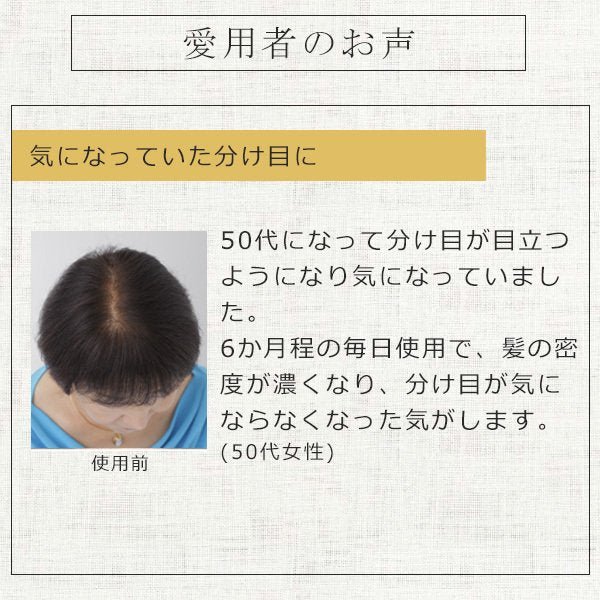 【3人シェア買いでお得】ヘアーモーメントＰ グロウエッセンス 155ml 育毛剤 女性用 養毛 育毛 薄毛対策 薄毛 抜け毛予防