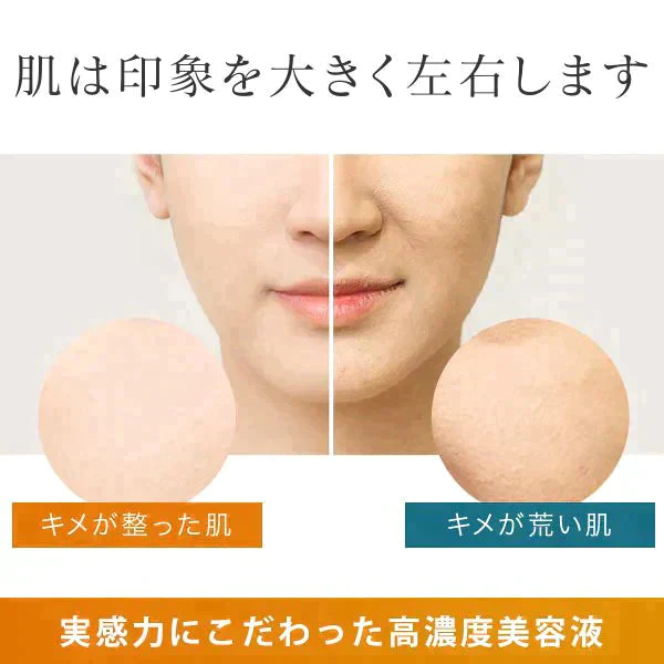 LDK1位 旧パッケージ Cエッセンス 10ml 美容液 ビタミンC誘導体 毛穴 ケア ビタミンC 5% 美容液 美顔器 イオン導入 メB プレゼント エッセンス エビス【ゲリラセール】