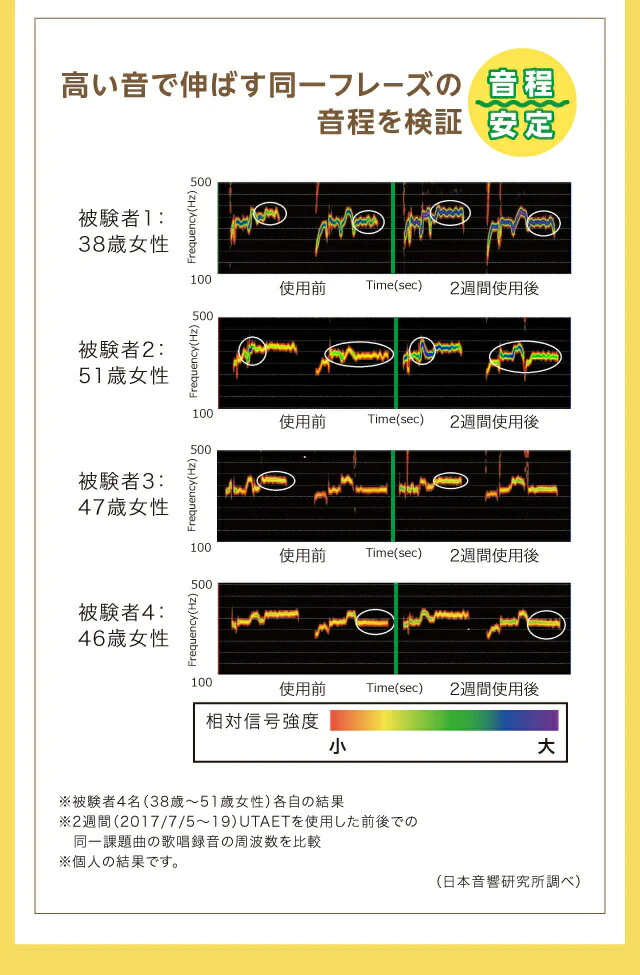 【グリーン 】ウタエット UTAET カラオケ 防音マイク ストレス解消 一人カラオケ 歌練 消音 発声練習 エクササイズ プレゼント