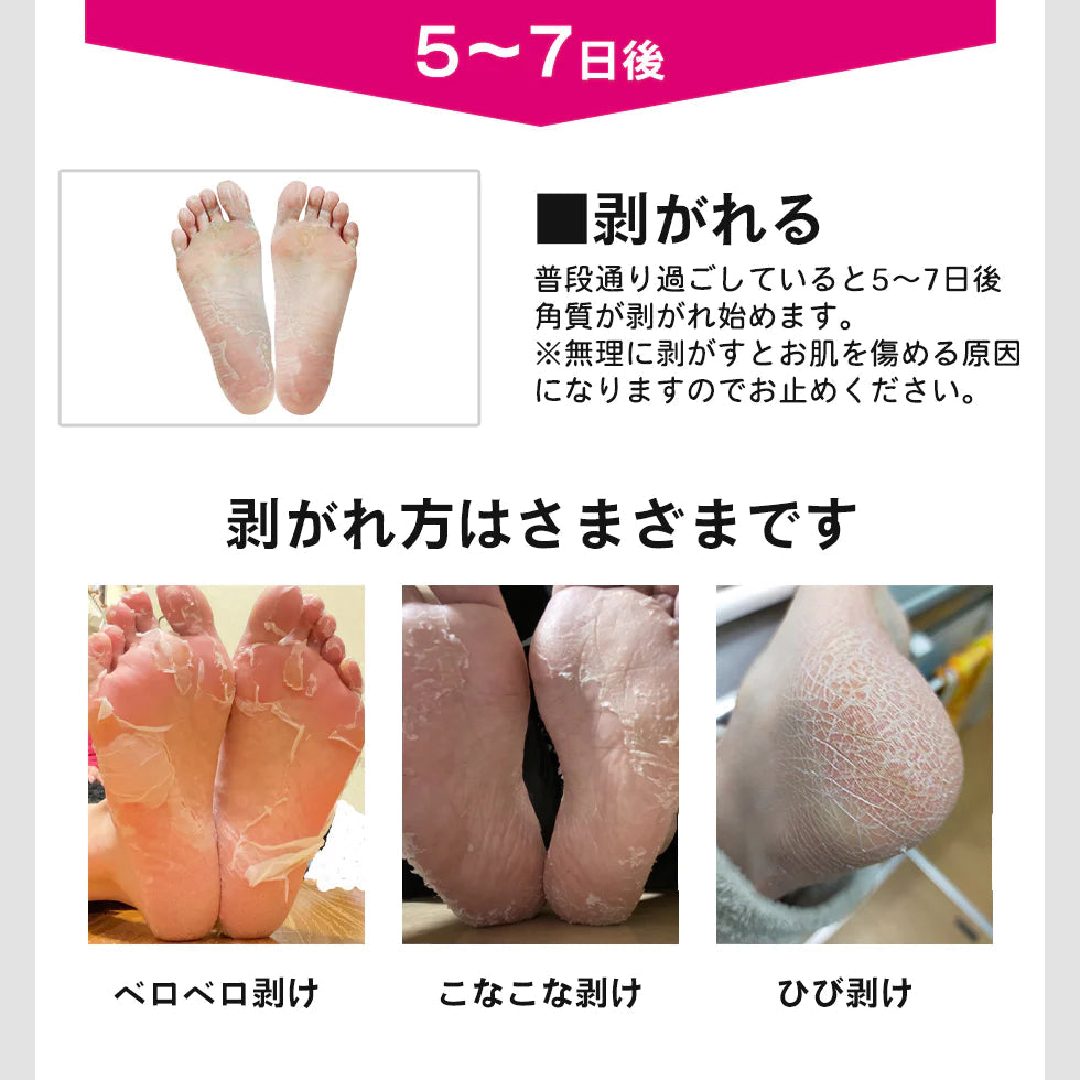【100円シェア買い】ましゅまろ素足 1回分 かかと 角質除去 足裏  両足×1回分 フットピーリング 時短 フットパック ペロリン 40分履くだけ 角質取り かかと ガサガサ ケア 足の臭い 角質 削る 足の裏 コスメ 化粧品 フットケア メール便 送料無料