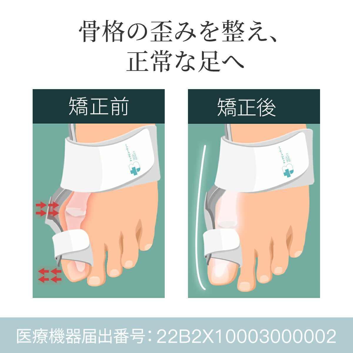 【2個セット】Tech Love　外反母趾サポーター 日本製 医療機器認証済
