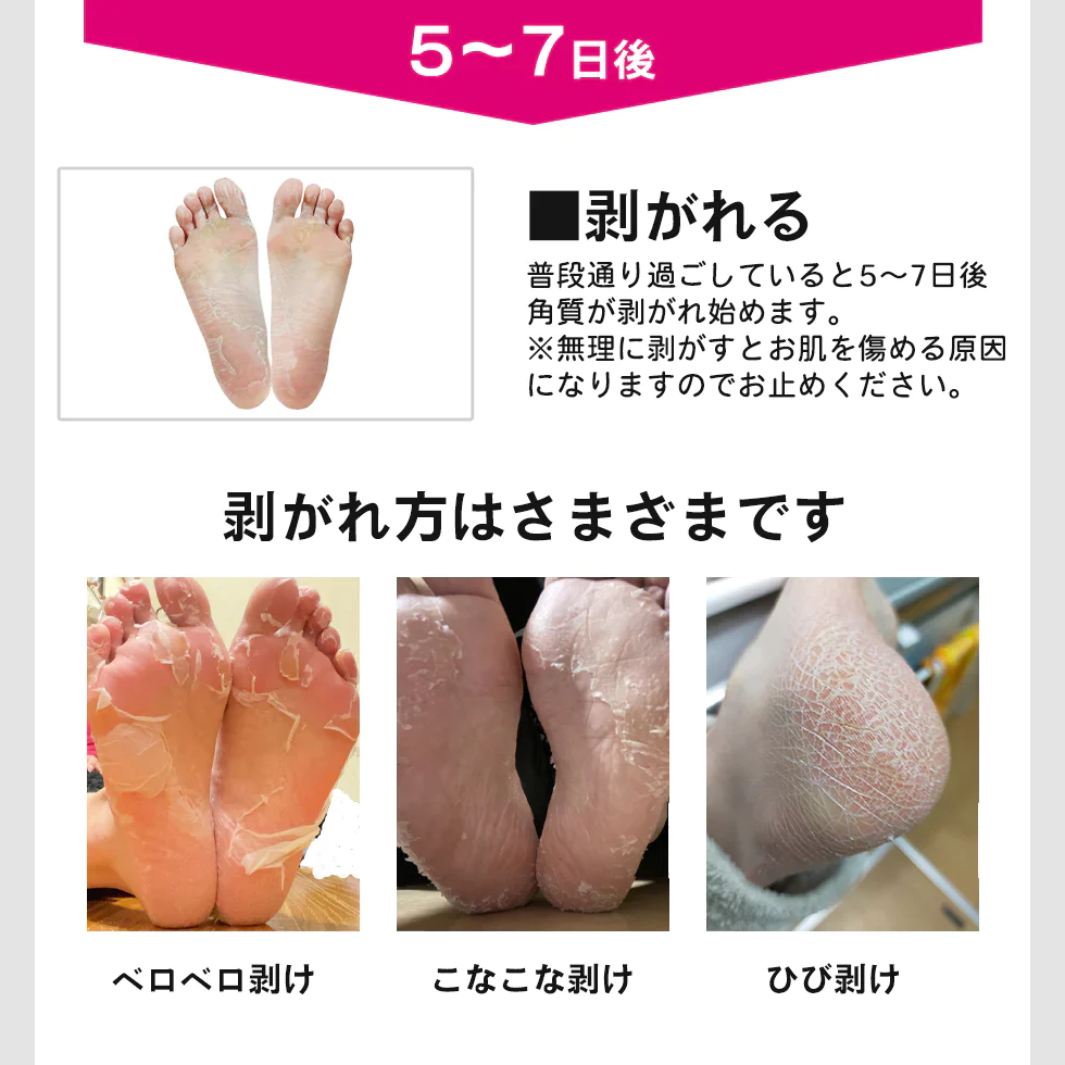 ましゅまろ素足 1回分 かかと 角質除去 足裏  両足×1回分 フットピーリング 時短 フットパック ペロリン 40分履くだけ 角質取り かかと ガサガサ ケア 足の臭い 角質 削る 足の裏 コスメ 化粧品 フットケア メール便 送料無料