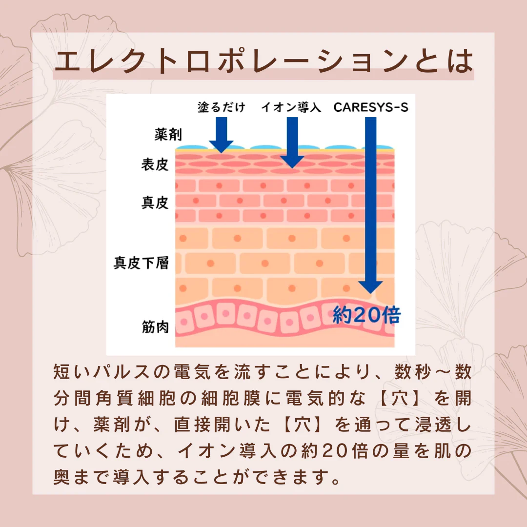 エレクトロポレーション（高濃度ヒアルロン酸導入）・吉井クリニック【美容クリニックチケット】