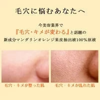 オラージュマンダリン10mL 毛穴 ケアに「マンダリンオレンジ果皮抽出液」100％原液美容液/毛穴 引き締めメB【ゲリラセール】
