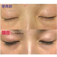 まつげ美容液 まつ毛美容液 伸びる 育毛 睫毛 トリートメント まつ毛 まつげ エイジング 目元ケア 低刺激 ディアモスト アイラッシュ 眉毛美容液 美容液 無添加 アルコールフリー ラッシュ エマーキッド ダメージケア ラッシュアディクト エグータム まつ育 高級 さくらの森