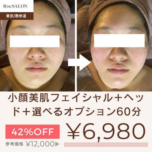 小顔美肌フェイシャル＋ヘッド＋選べるオプション60分　【美容サロンチケット】美容/エステ/フェイシャル/東京/表参道/RiseSALON