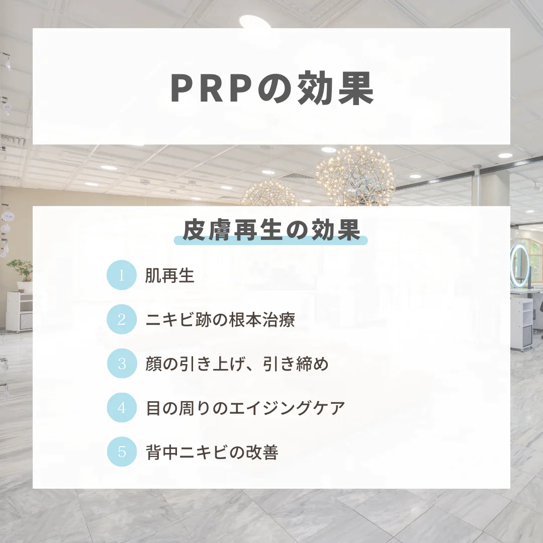 PRP注射（1cc）※初診料込（ノリス美容クリニック）【美容クリニックチケット】
