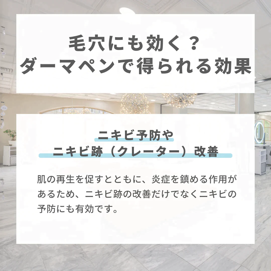 ダーマペン（麻酔付き）ヒアルロン酸※初診料込（ノリス美容クリニック）