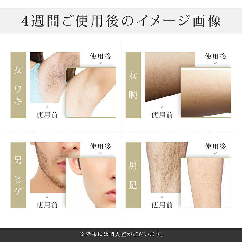 【箱不良アウトレット品】Omuse 脱毛器 グリーン【エコ得】