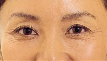 トミーリッチ　マジックリンクルスティック