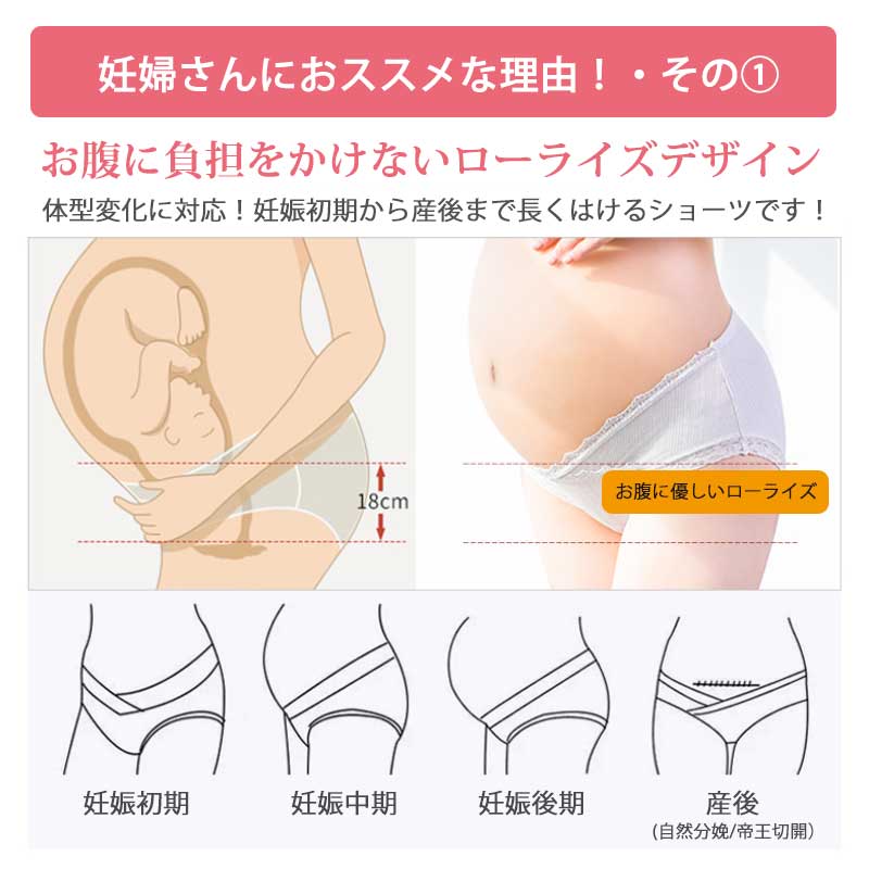 【セットA  Lサイズ】 マタニティショーツ ローライズ 3枚セット 綿 レース マタニティ ショーツ パンツ コットン 通気性 伸縮性 肌に優しい 下着 インナー 冷え対策 無地 産前 産後